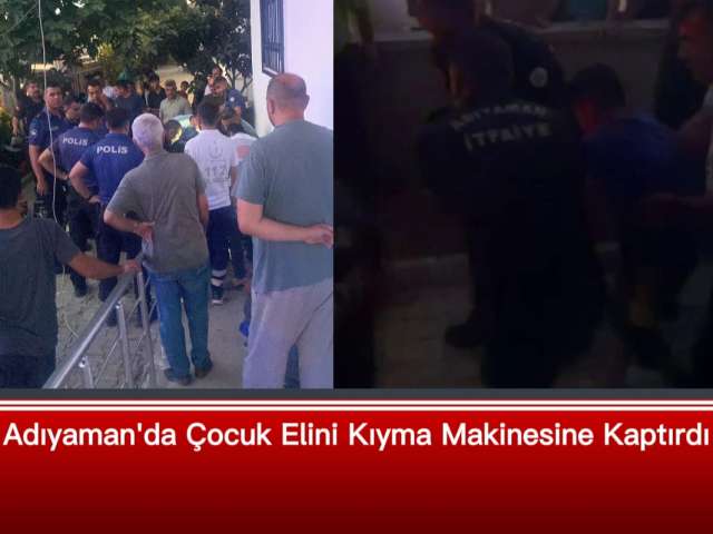Kıyma Makinesi Elini Kaptırdı